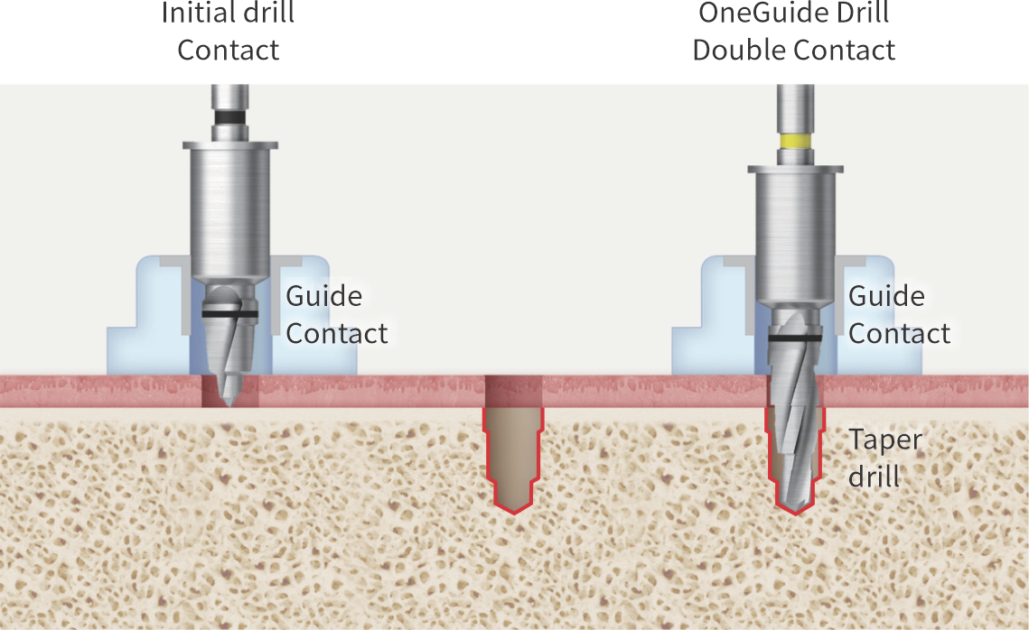 Accurate surgery