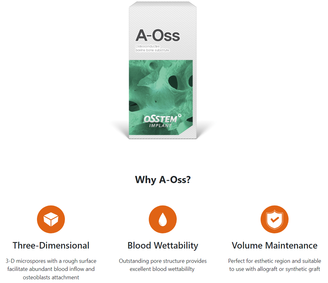 Why A Oss