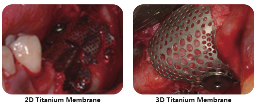 3D Design Maximize Clinical Convenience