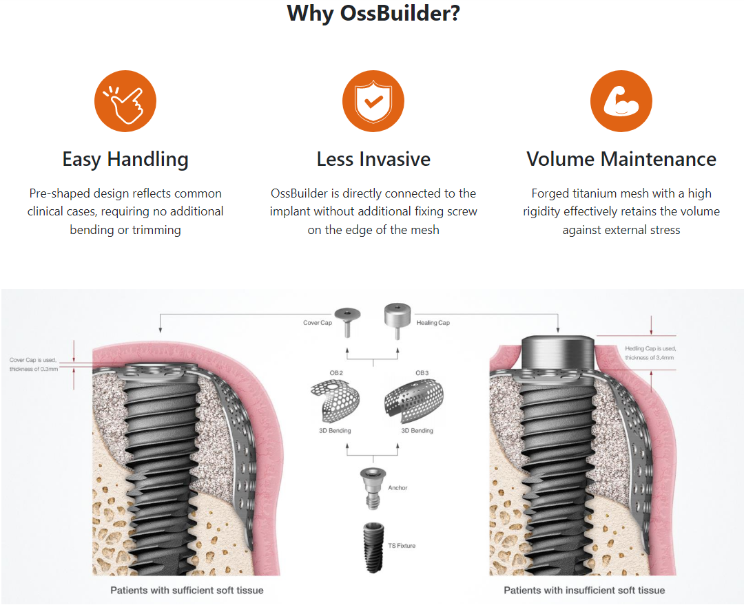 Why OssBuilder