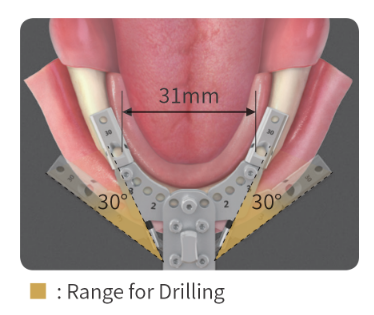 Can be used in various clinical cases
