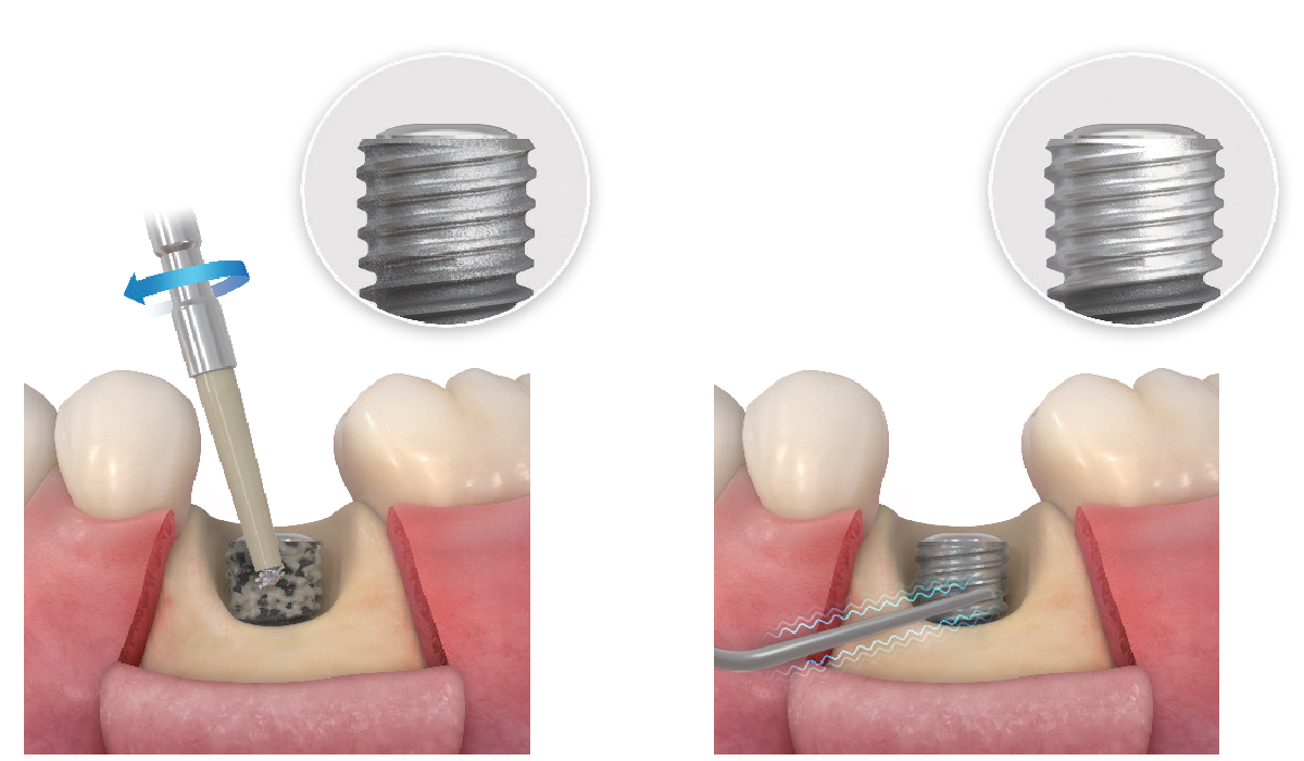 IMCureKit Feature01